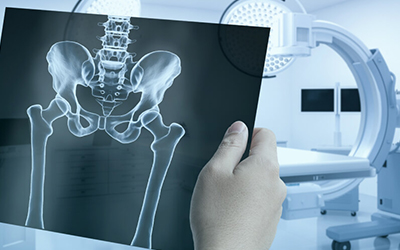 Wafid X-ray